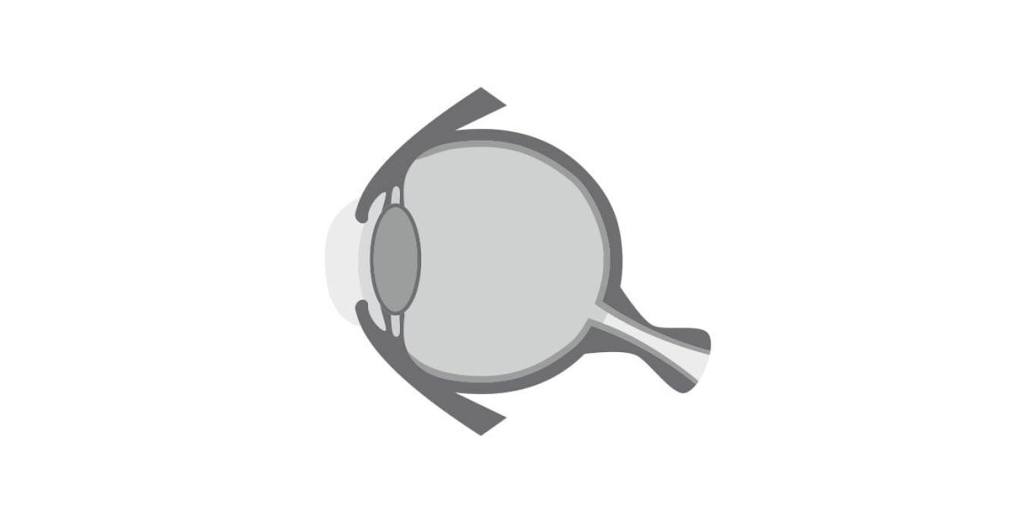 MENU-AFECCIONES_0000_anatomia-del-ojo.jpg