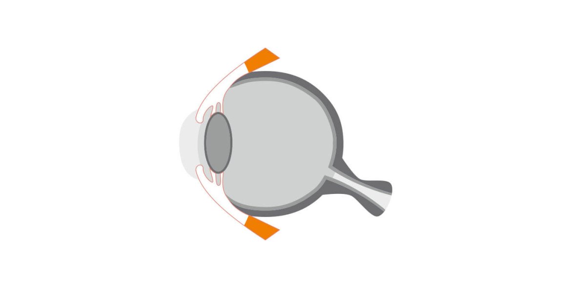 MENU-AFECCIONES_0001_glóbulo-y-músculos-oculares.jpg