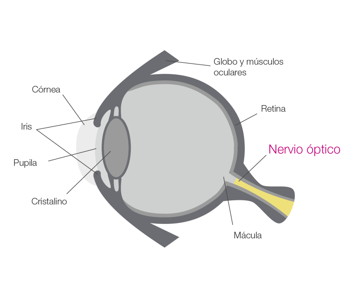 afecciones-nervio-optico-01.png