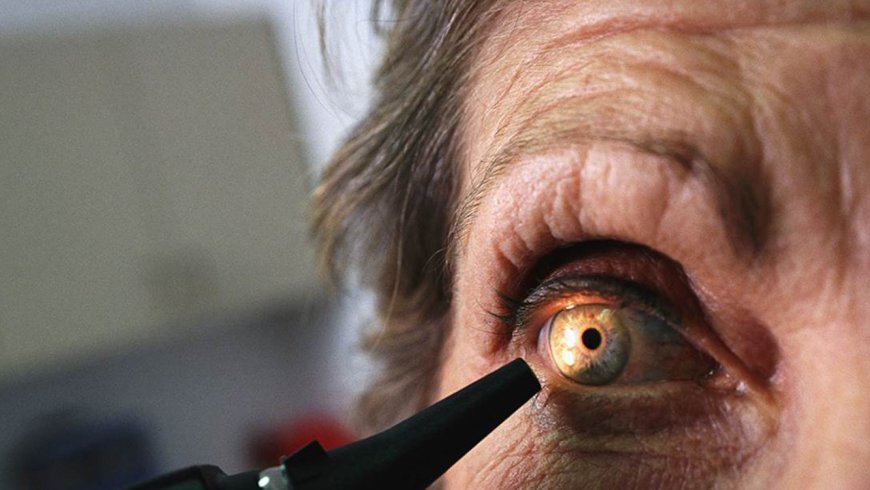 5 tips para prevenir la ceguera a causa de la diabetes