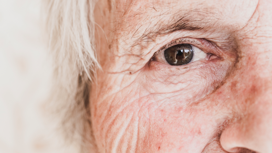 Cuidados oculares en el adulto mayor