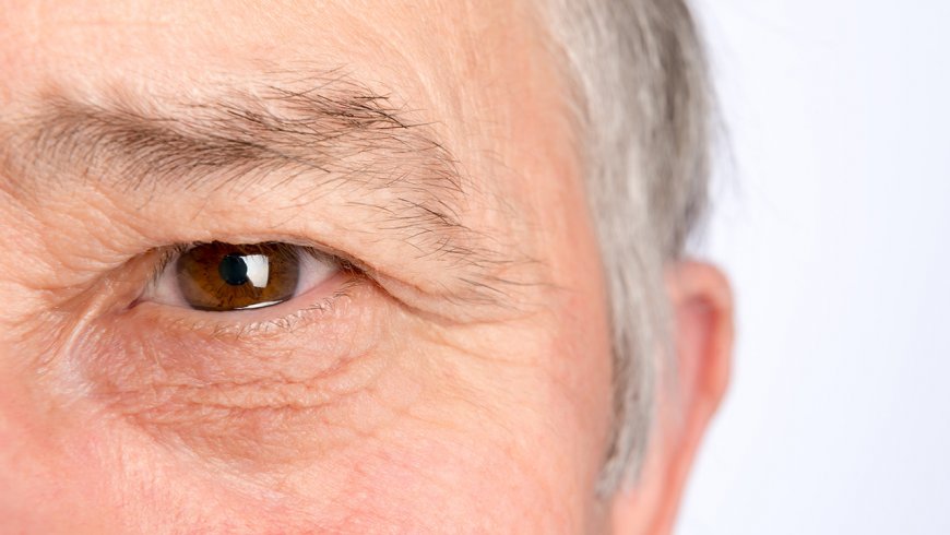 Glaucoma: 4 mitos sobre el ladrón silencioso de la visión