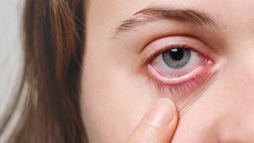 Día Mundial de la Uveítis: una enfermedad poco conocida que puede acabar en ceguera